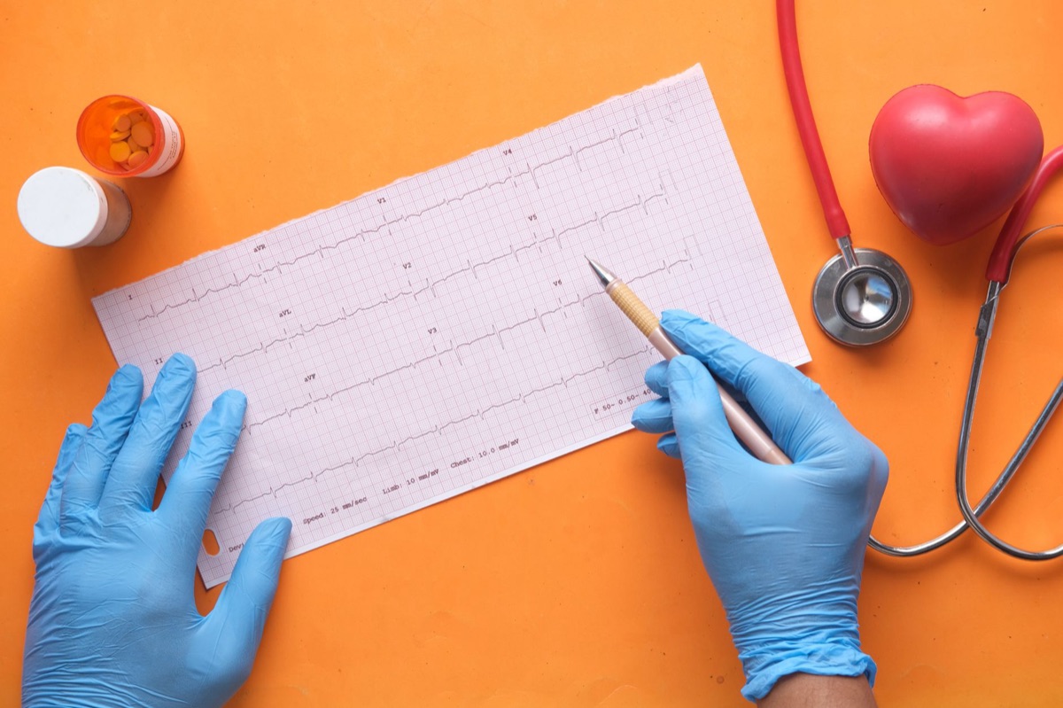 medical chart showing iron levels