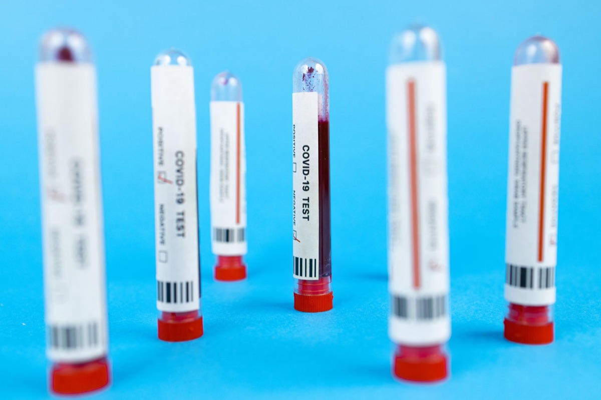 kit de pruebas sanguíneas médico