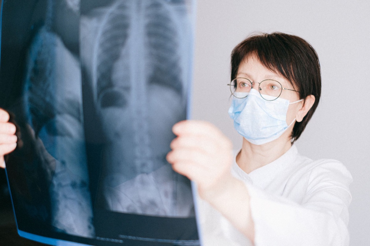 médico examinando paciente com máscara de apneia