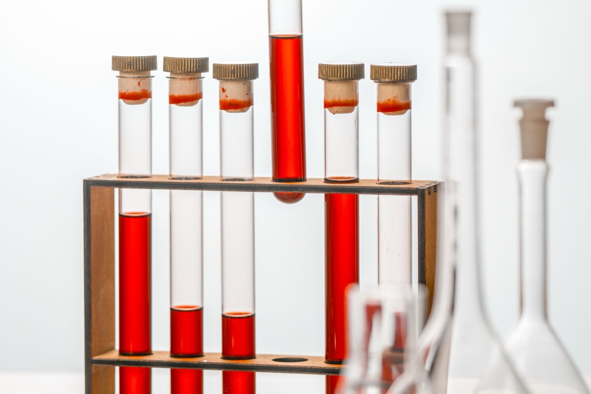 Omega 3 Triglycerides in a lab vial