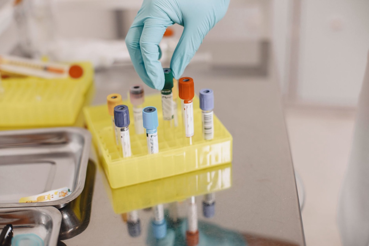 Medical researcher with lab vial