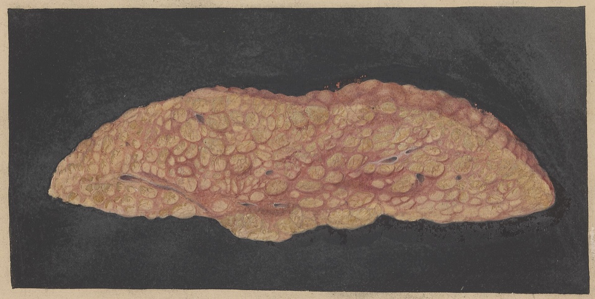 foie avec graisse