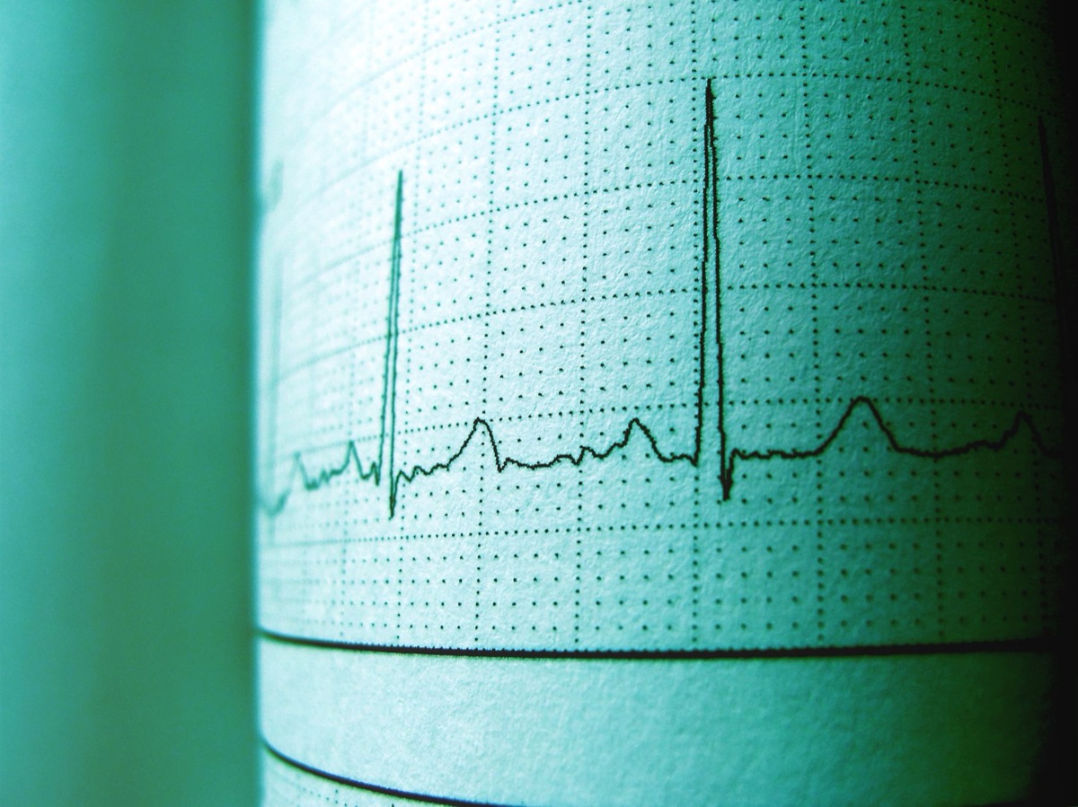 Herz-EKG-Maschine