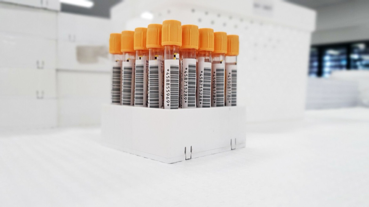 tube sang test enzyme cardiac