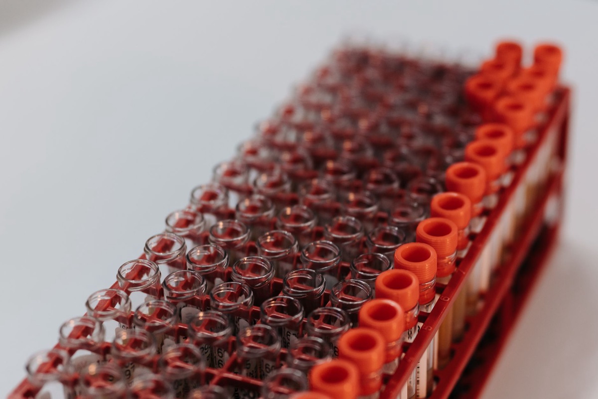 blood test tube with heart enzymes