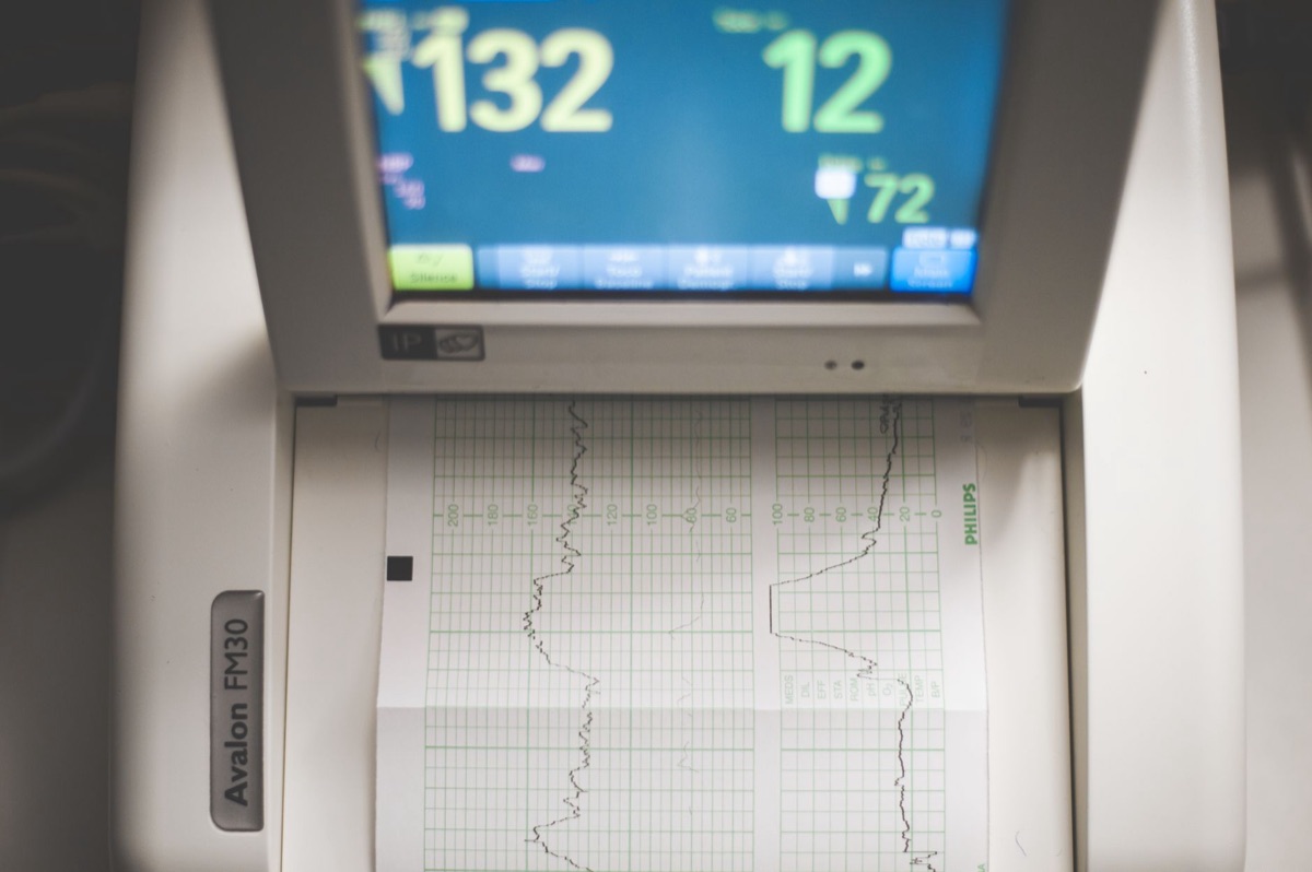 hartelectrocardiogram machine