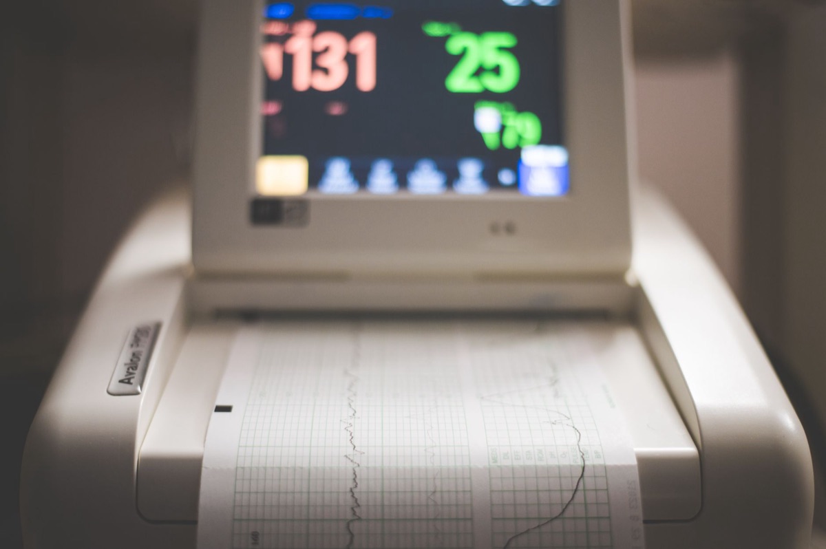 monitor de eletrocardiograma
