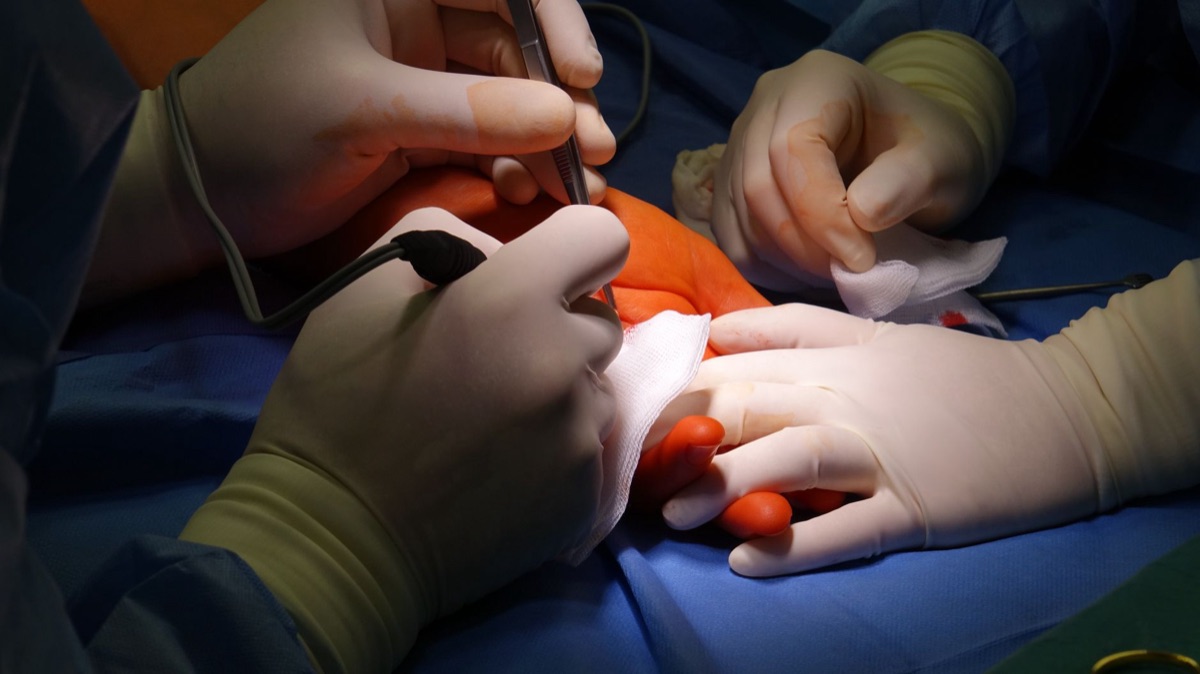 comparison of surgical procedures